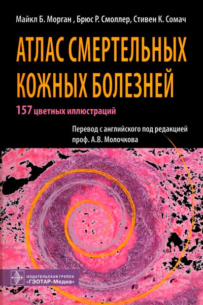 Атлас смертельных кожных болезней