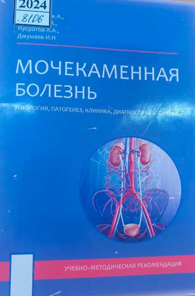 Мочекаменная болезнь