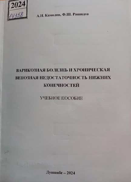 Варикозная болезнь