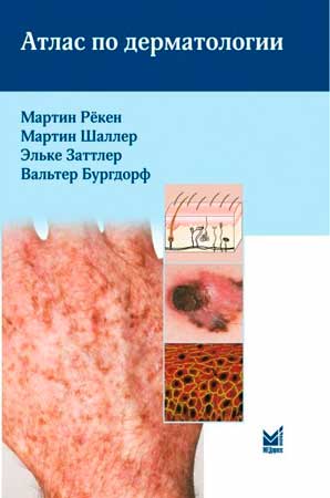 Атлас по дерматологии